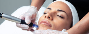 Regenerate Your Skin With Microneedling