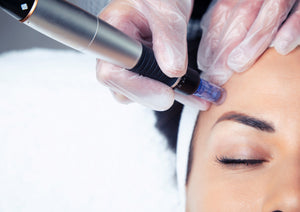 Microneedling 101