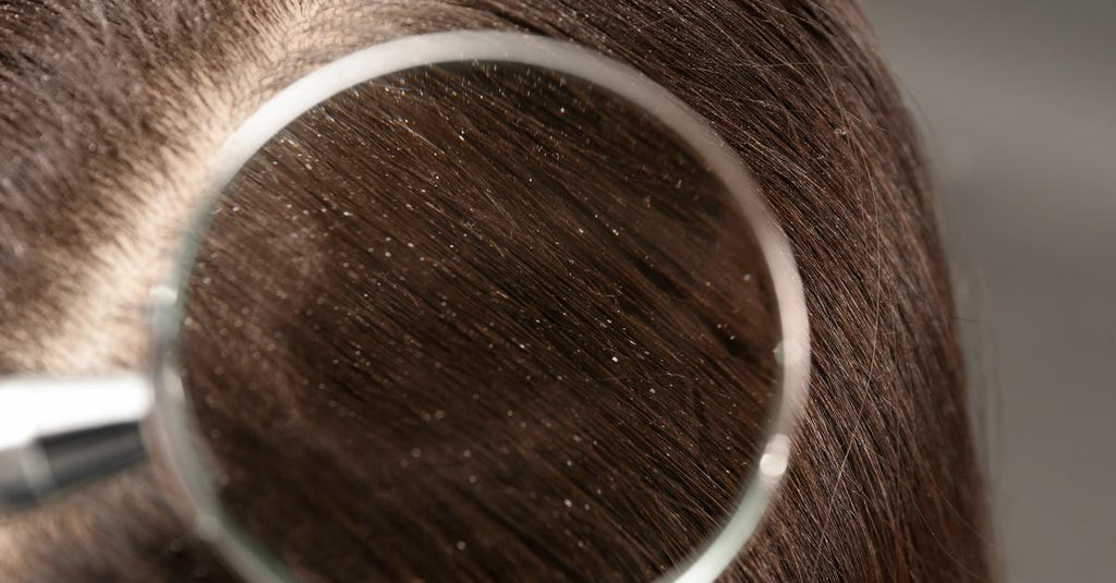 Dandruff vs. Dry Scalp: What's The Difference?